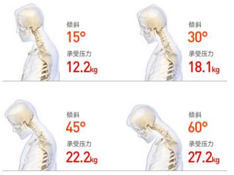 頸椎僵硬怎么辦？三步告別頸椎煩惱